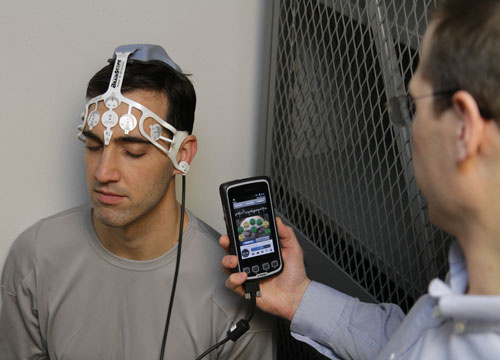 A bethesdai BrainScope Company funkcionális MRI és kézi EKG-készülék alkalmazásával tervezi kiértékelni a traumás agysérülés gyors és objektív felmérésének módszereit. A bethesdai BrainScope Company funkcionális MRI és kézi EKG-készülék alkalmazásával tervezi kiértékelni a traumás agysérülés gyors és objektív felmérésének módszereit.