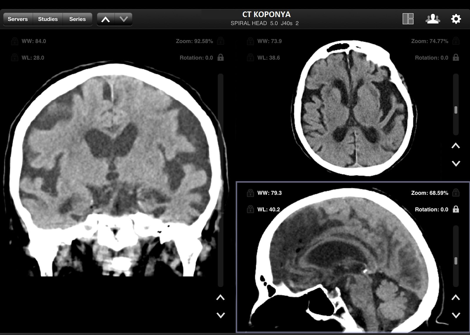 Ilyen és hasoló leleteket továbbít a rendszer.