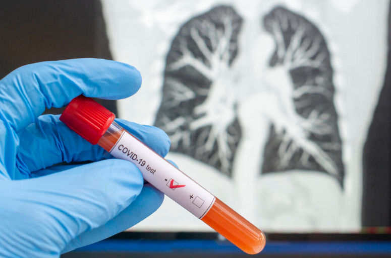 Magyar kutató: búzacsíra kontra koronavírus