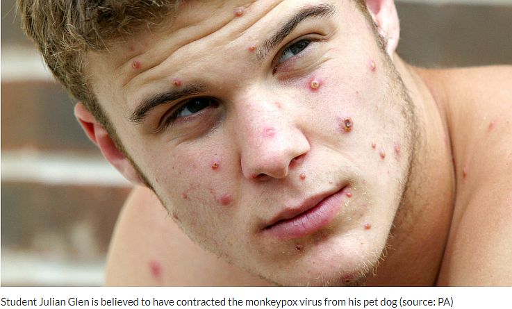 Majomhimlő elleni vakcinák az uniós tagállamoknak EU-pénzből