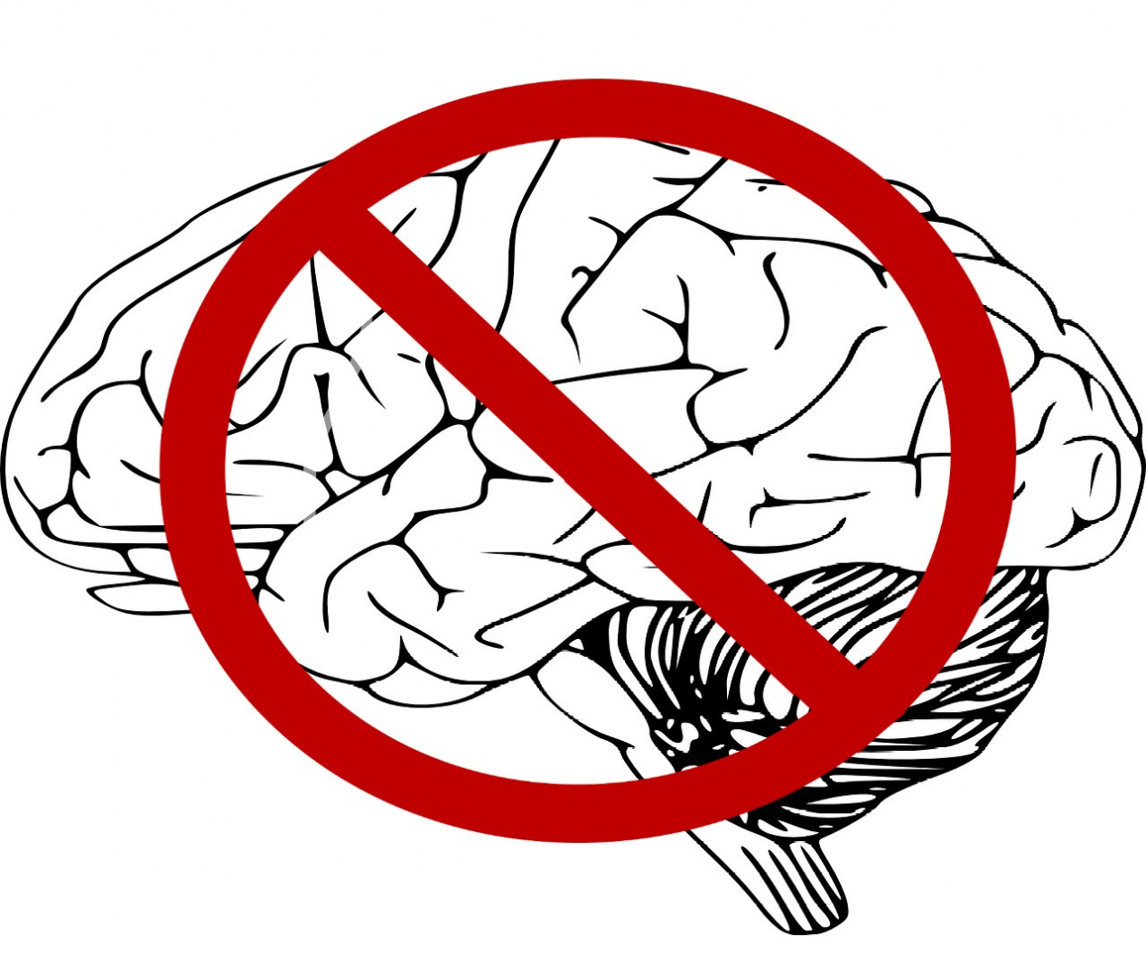 Cinizmus és agyhalál