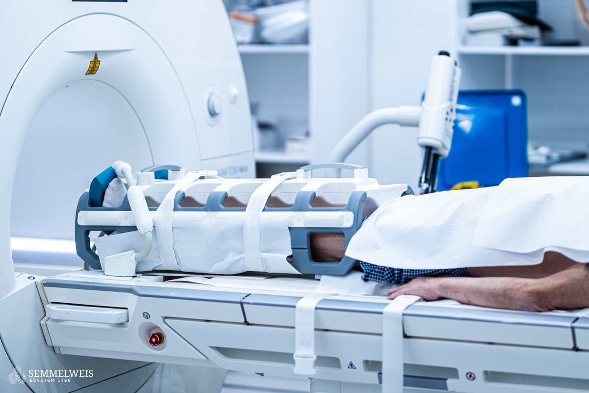 Egyedülálló érszűkület-vizsgálat a végtagok megmentésére